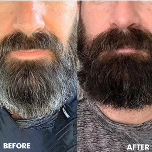 Anti-Grey Hair Prime Serum for Head & Beard | 100% Organic & Effective