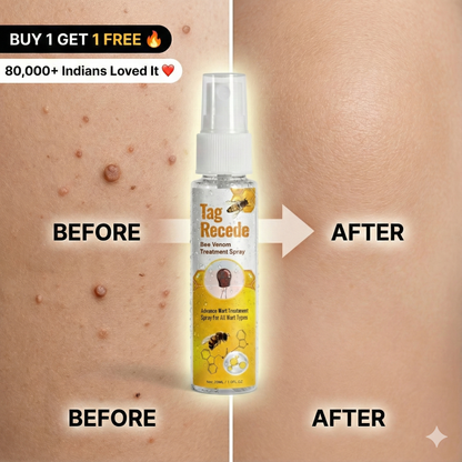 Wart & Skin Tag Remover Spray