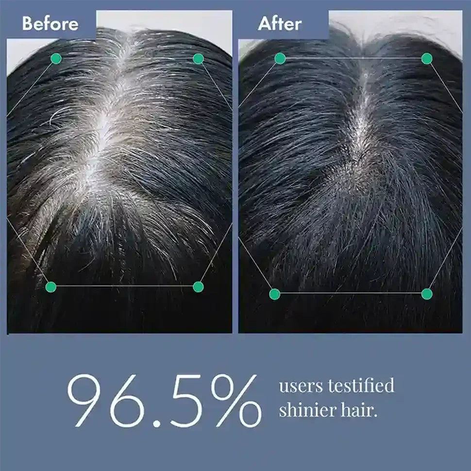 Anti-Grey Hair Prime Serum for Head & Beard | 100% Organic & Effective